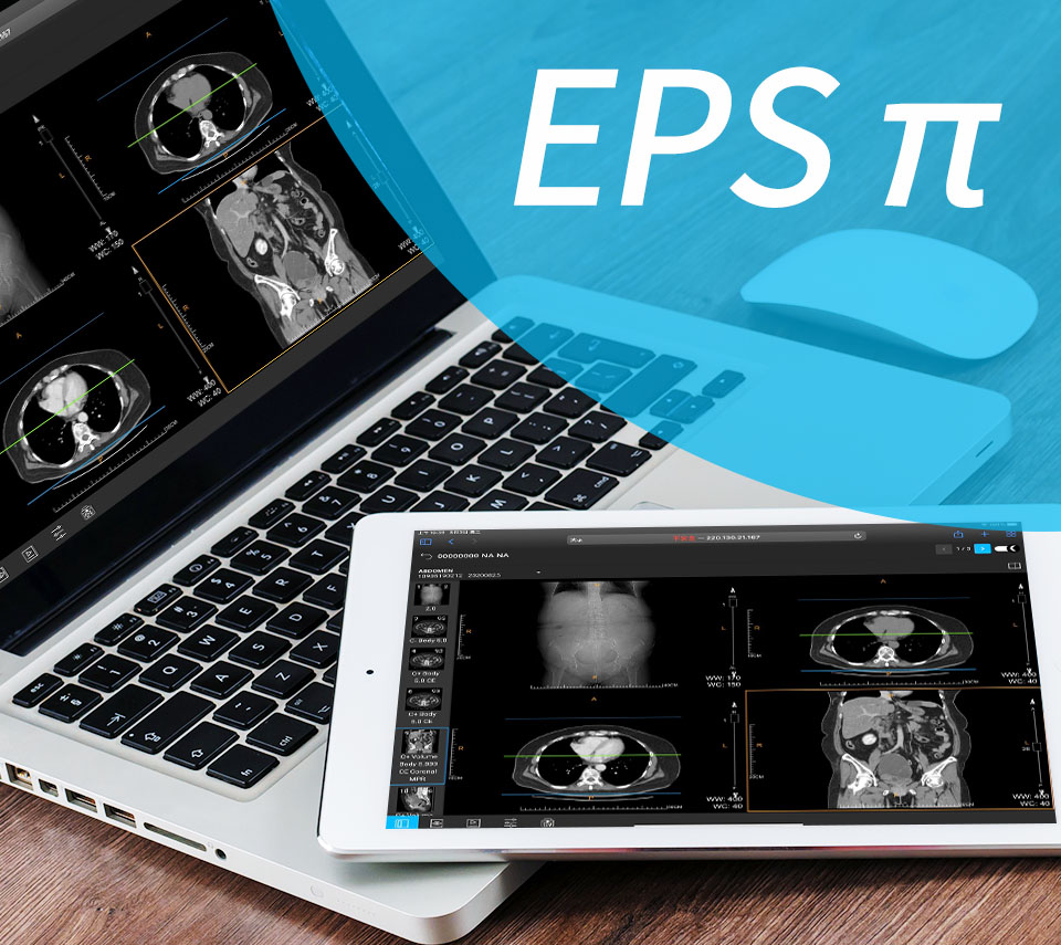 Allscripts Epsi EBM EPS Pi